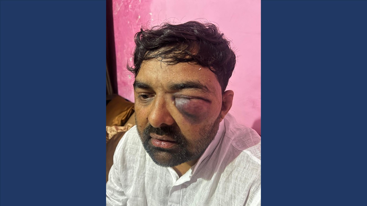 Farmer Leaders Allege Brutal Custodial Assault in Meerut, ADG Orders Probe